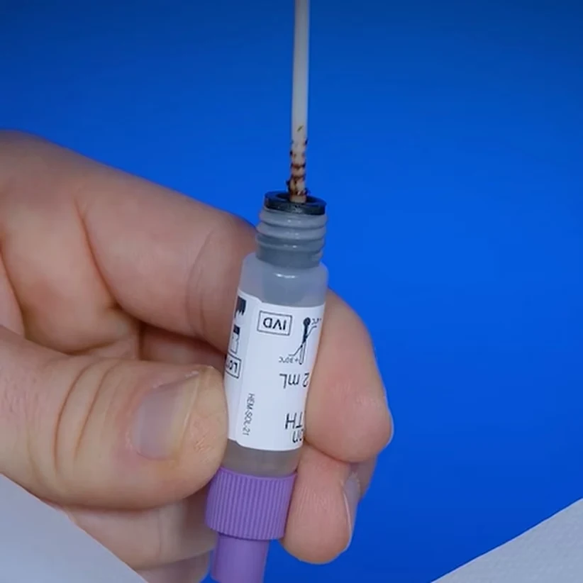 Immunochemische Fecale Occult Bloedtest van Patris Health – stap 2, het bemonsteringsstaafje terug in het flesje met extractievloeistof